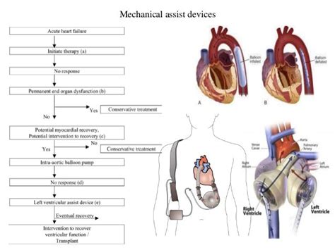 lvf medical treatment